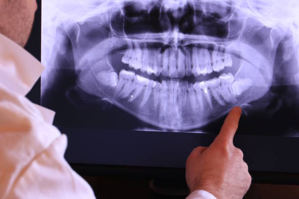 Best Emergency Denture Repair in Ramona, CA